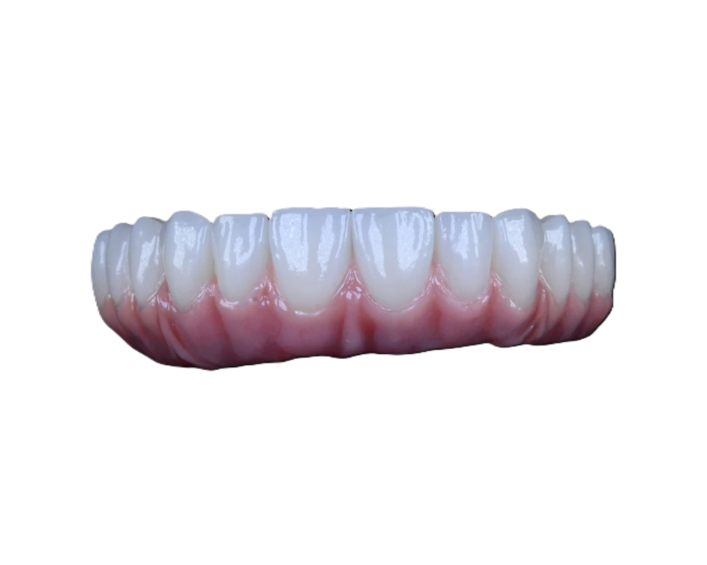 Lucrare Dentallx — fațete ceramice nr. 1