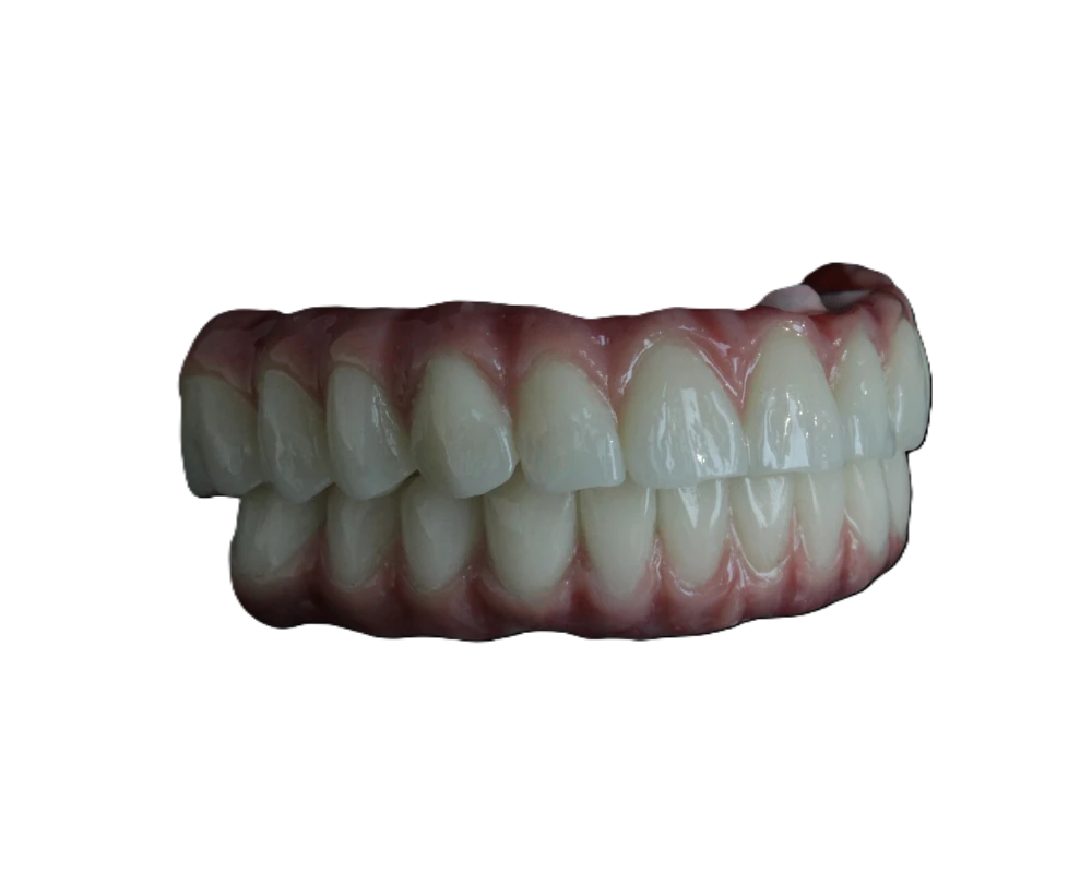 Lucrare Dentallx — smile styling nr. 10