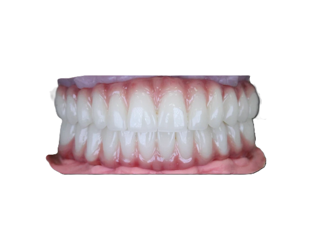 Lucrare Dentallx — ceramică nr. 11