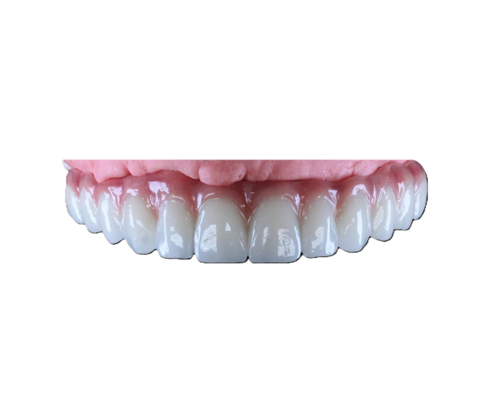 Lucrare Dentallx — smile design nr. 3