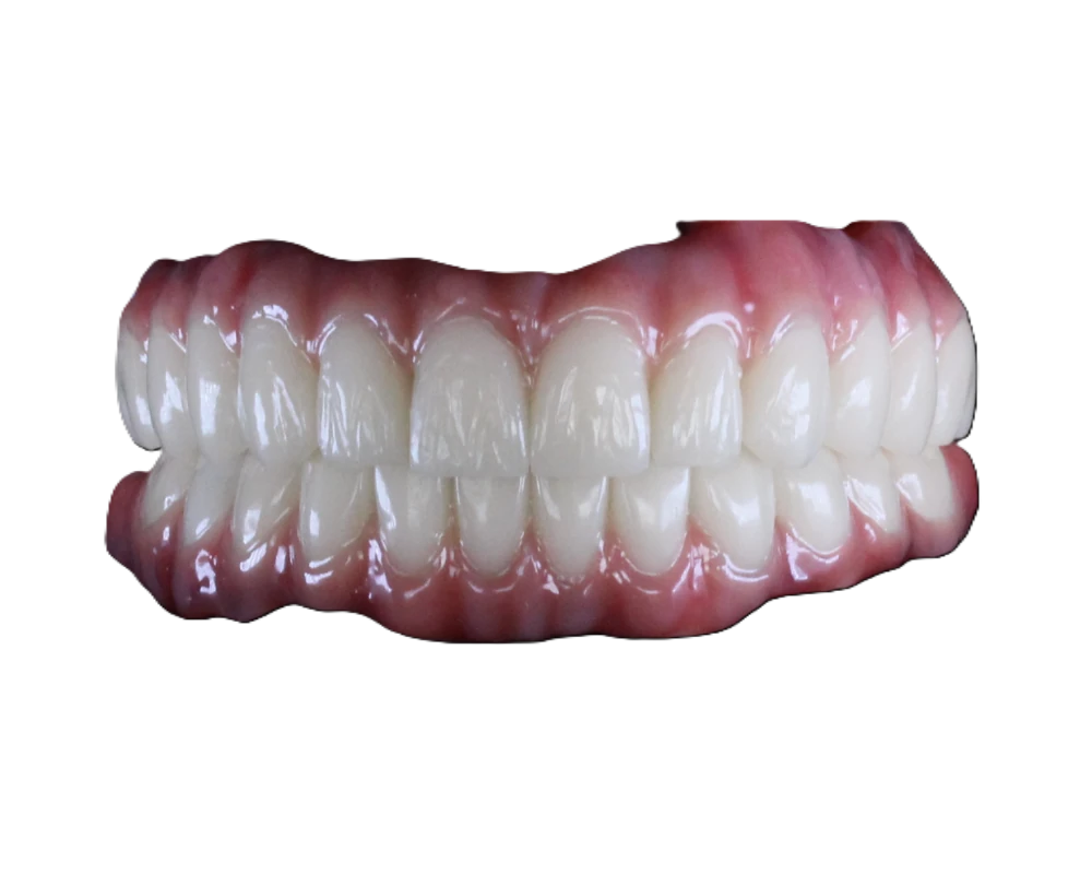 Lucrare Dentallx — implant protetic nr. 4