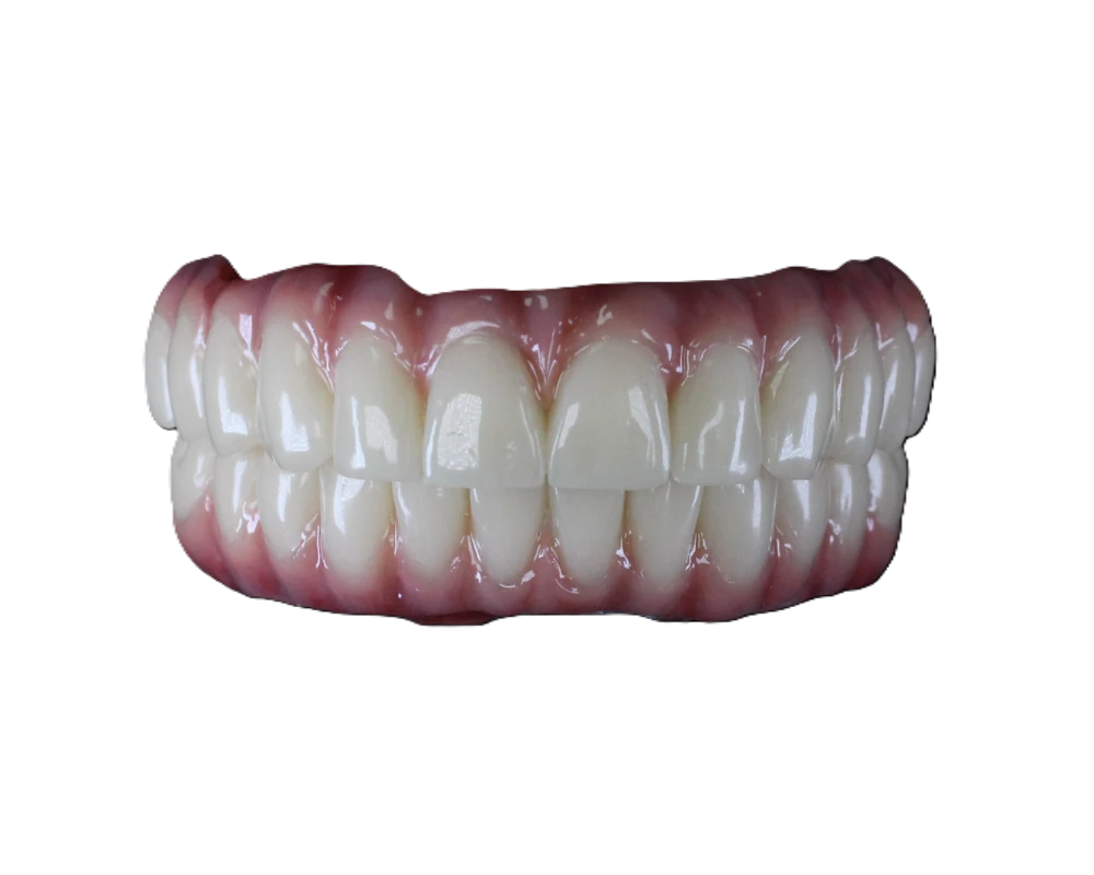 Lucrare Dentallx — fațete nr. 6