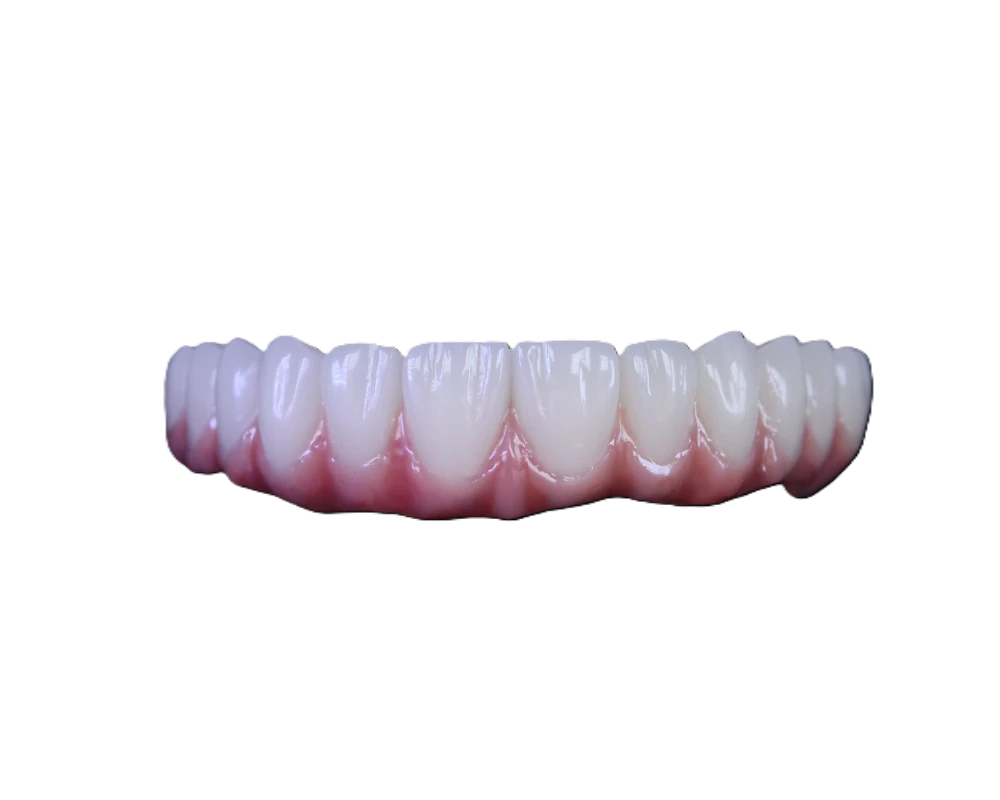 Lucrare Dentallx — proteză scheletată nr. 7