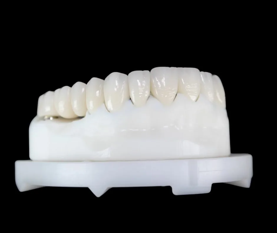 Restaurare full zirconiu